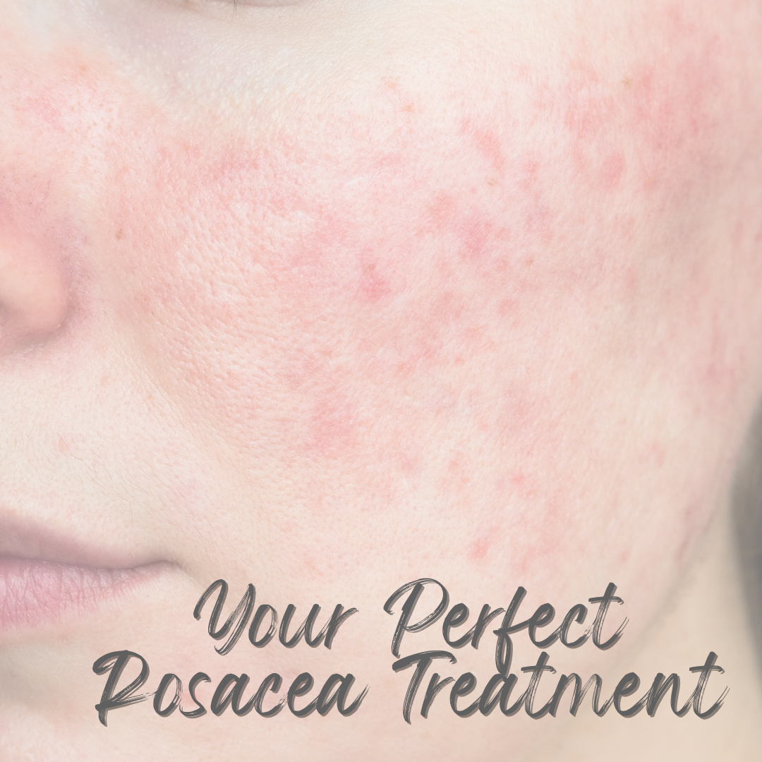 The Powerful Duo That Can Reduce Rosacea 