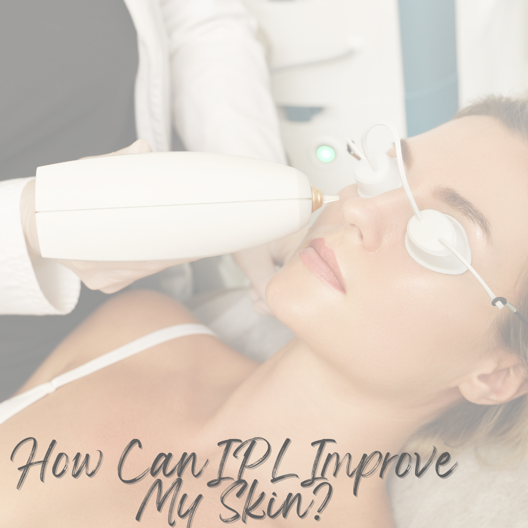 How Can IPL Improve My Skin?