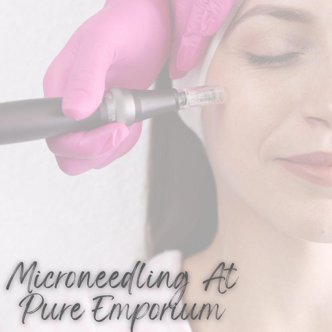 The Difference Between In-Clinic and At-Home Microneedling