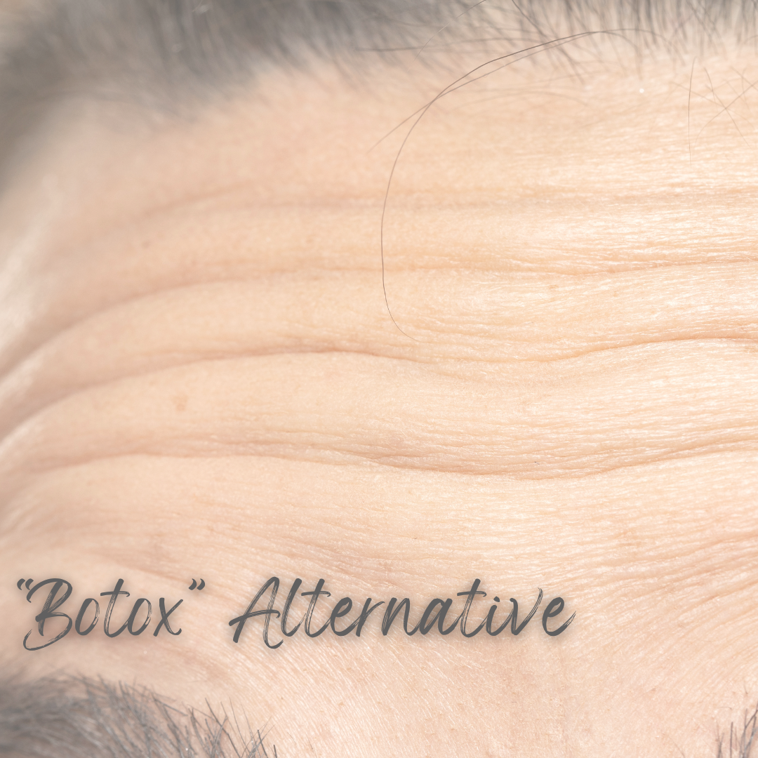 A Pregnancy Safe "Botox" Alternative
