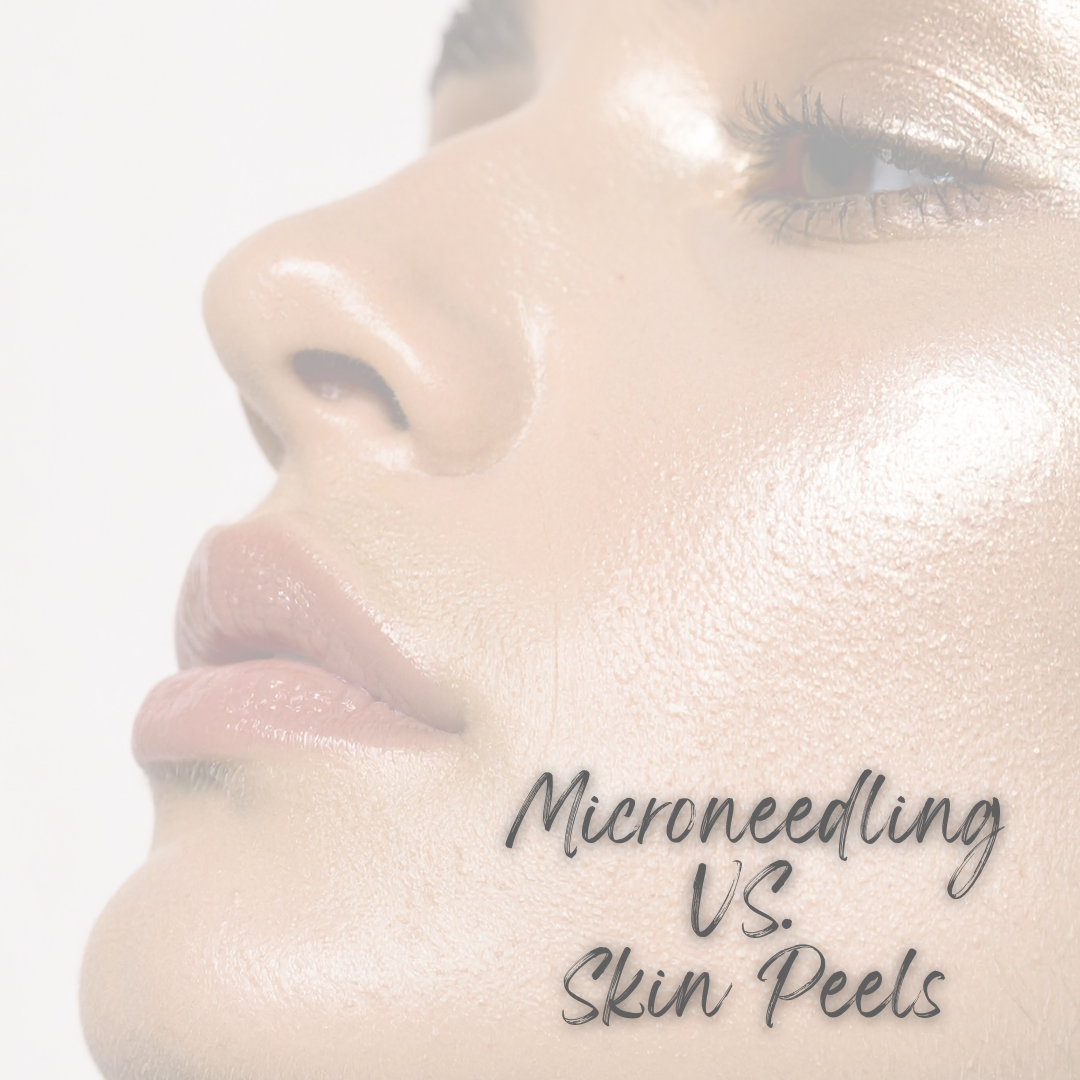 Microneedling VS. Skin Peels: Which Is Right For You?