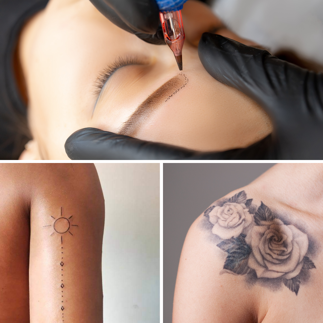 Laser Tattoo Removal for unwanted tattoos