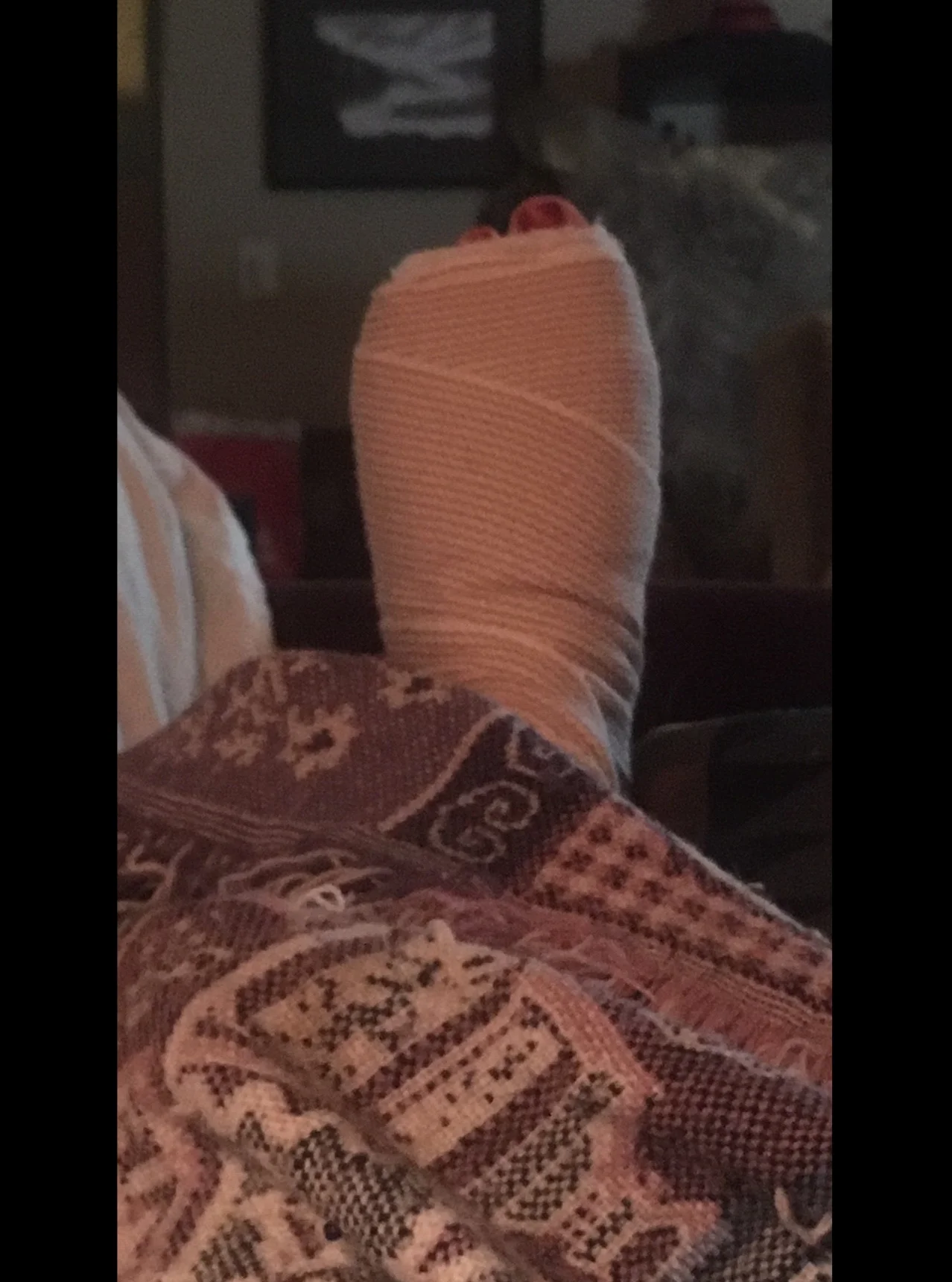  My Left Foot