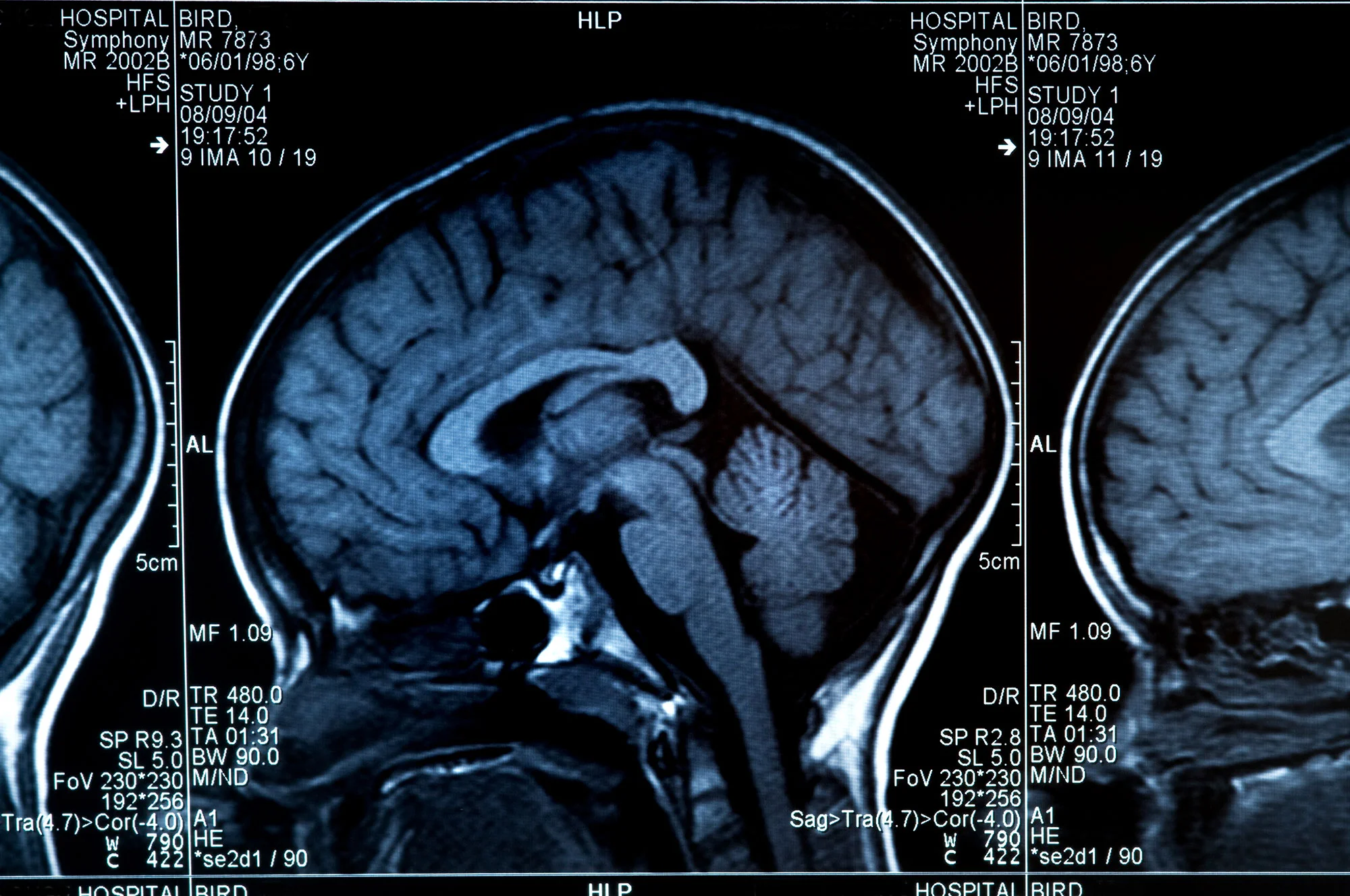 iStock-157399901.jpg