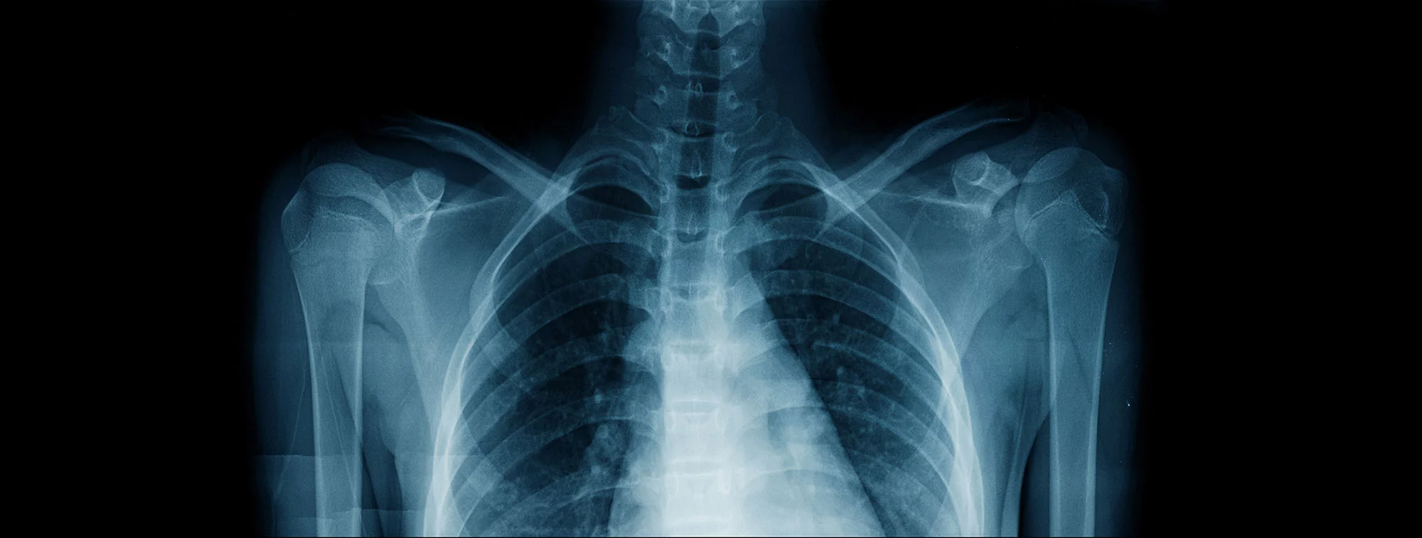 Cervical.jpg