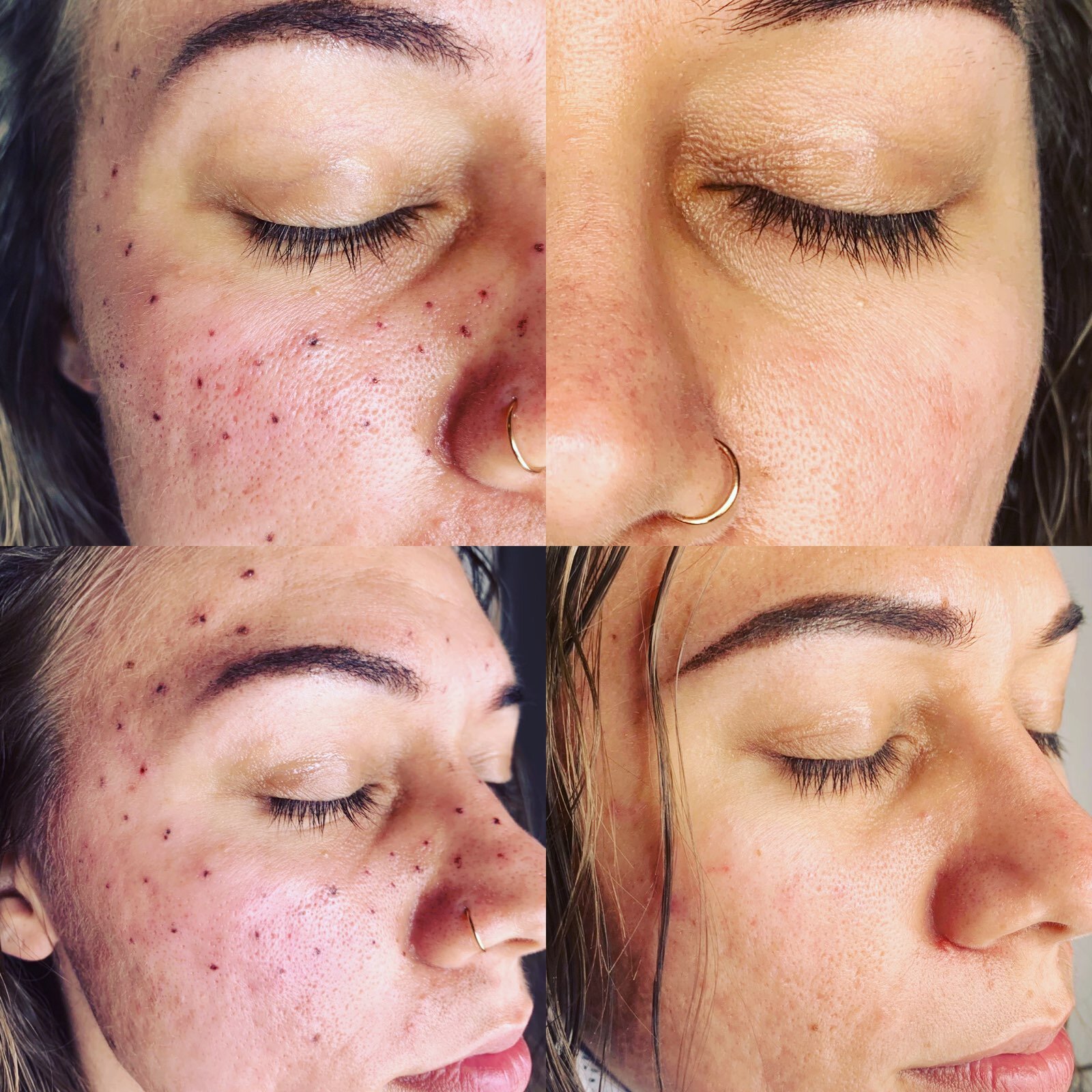 forkæle tag på sightseeing skrædder Permanent Makeup Before & Afters — Skin Studio OKC