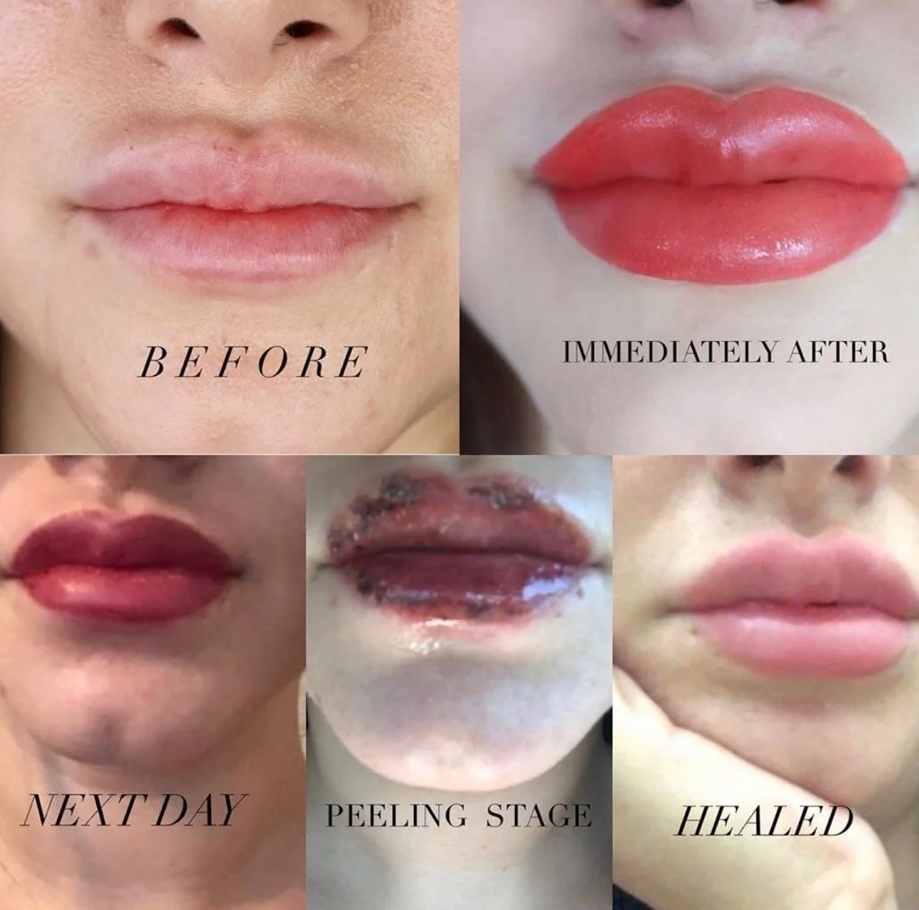 Before & Afters — Skin Studio OKC