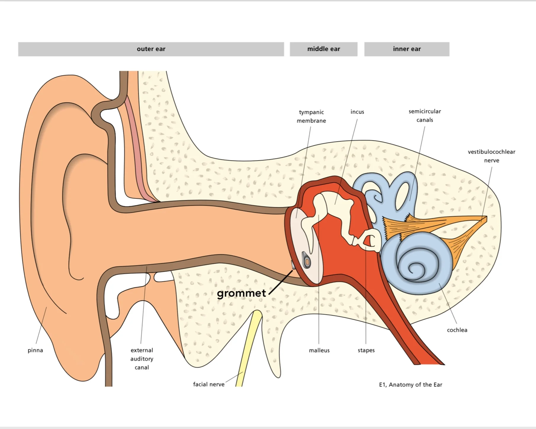What is a grommet? — ent4kids