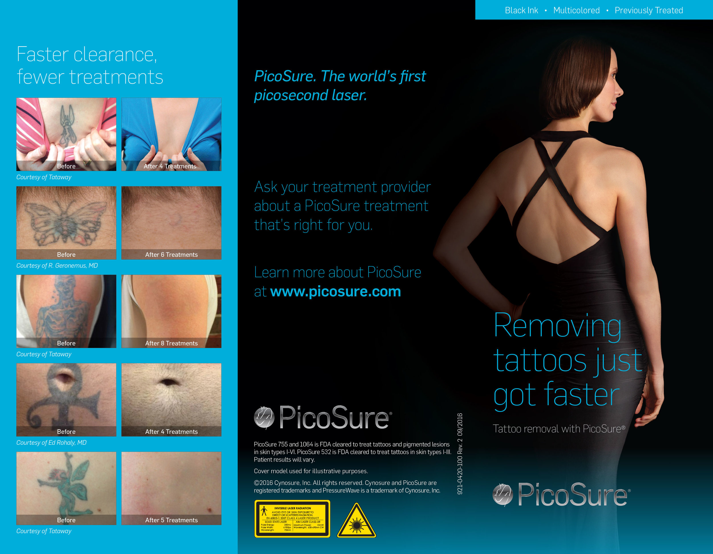 PicoSure_Brochure_Tattoo-1.jpg