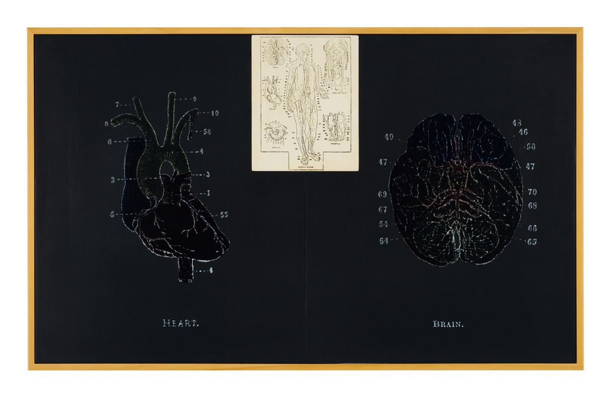 Mappings: The Arterial System