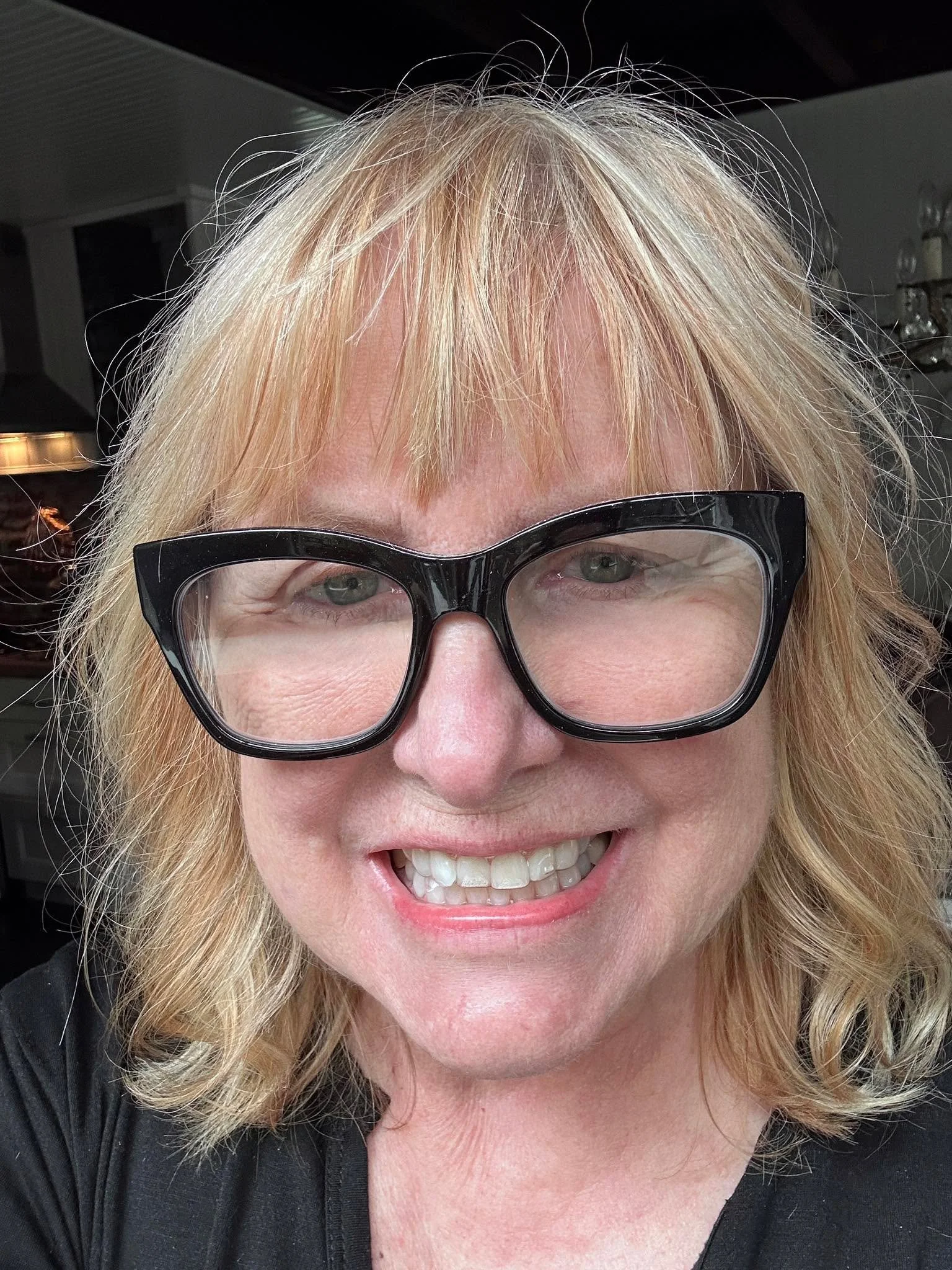 Hey Guys! I got braces! Who knew that as you age- your teeth can really shift and create problems for your health?! I have Candid Pro Aligners from Dr Shyue and his team at Willapa Dental. It will be about a year - less if I follow the plan well. The