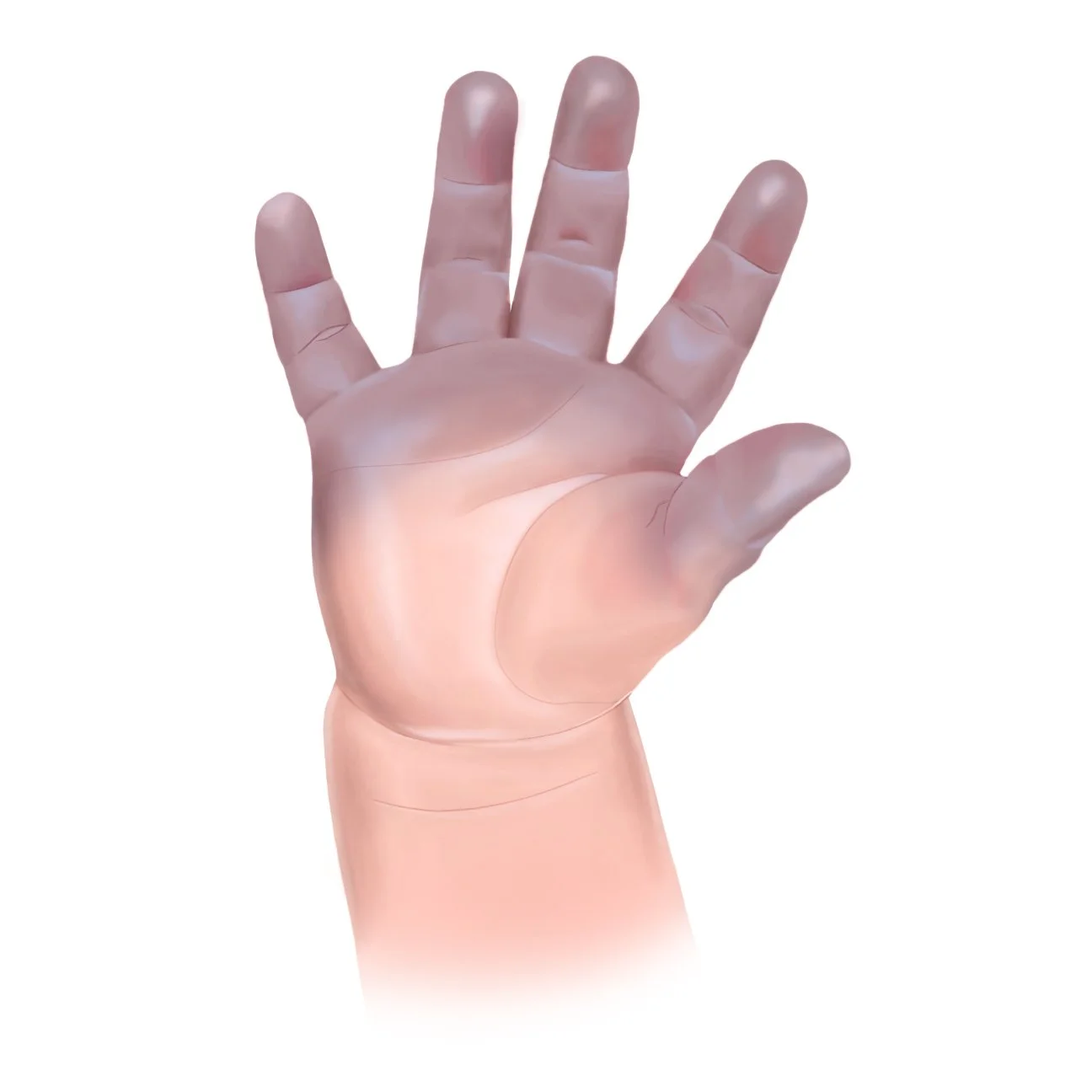 cyanosis Hand copy.jpg