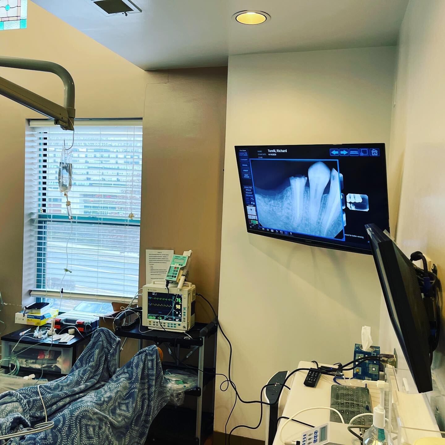 No matter how small the room we always manage to safely setup 

 #dentalimplants #dentalimplant #dentalsedation #dentalanesthesia #officeanesthesia #sedationdentistry