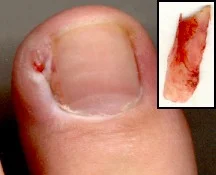 toenail.jpg