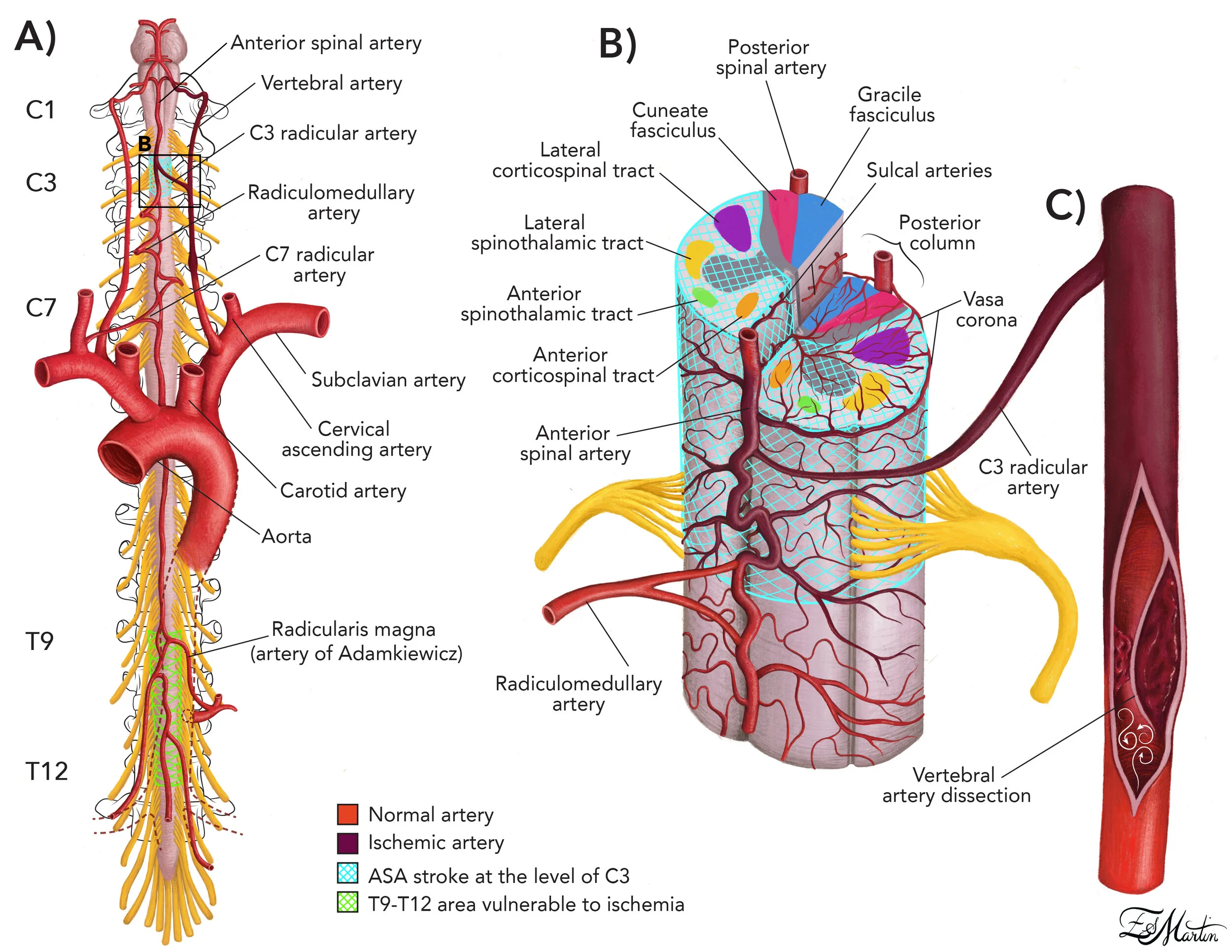 Spinalcord_arteries_V6.jpg