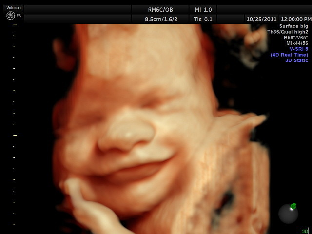 ultrasound_face_2.jpg