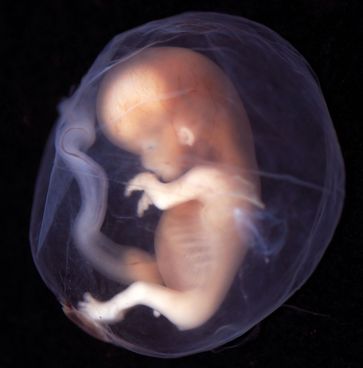 fetal_development_19.jpg