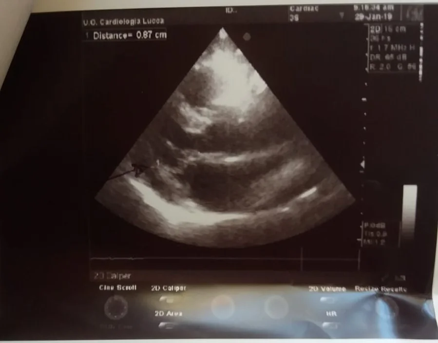 From the plane and hearth...