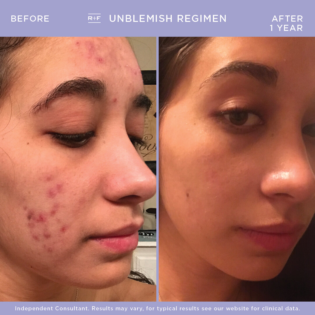 UNBLEMISH B&A - Sasha.jpg