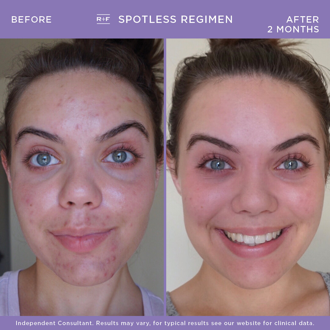 SPOTLESS B&A - Sarah .jpg