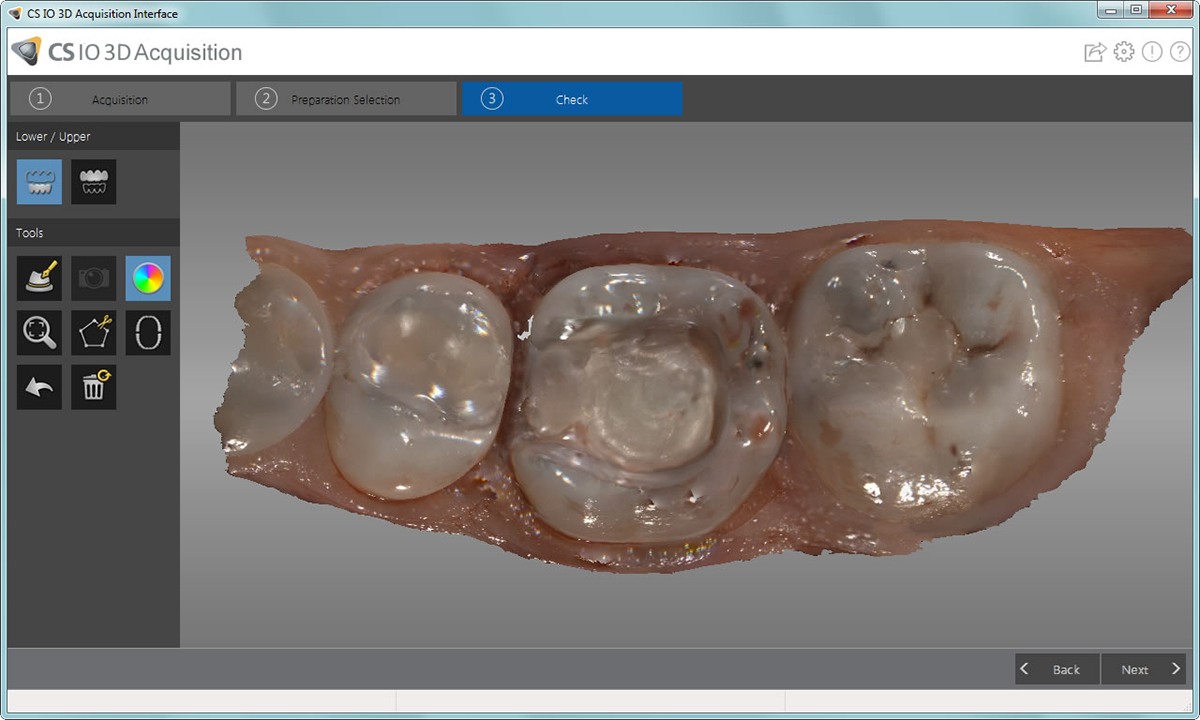 Intraoral Scanner — Elite Care Dental