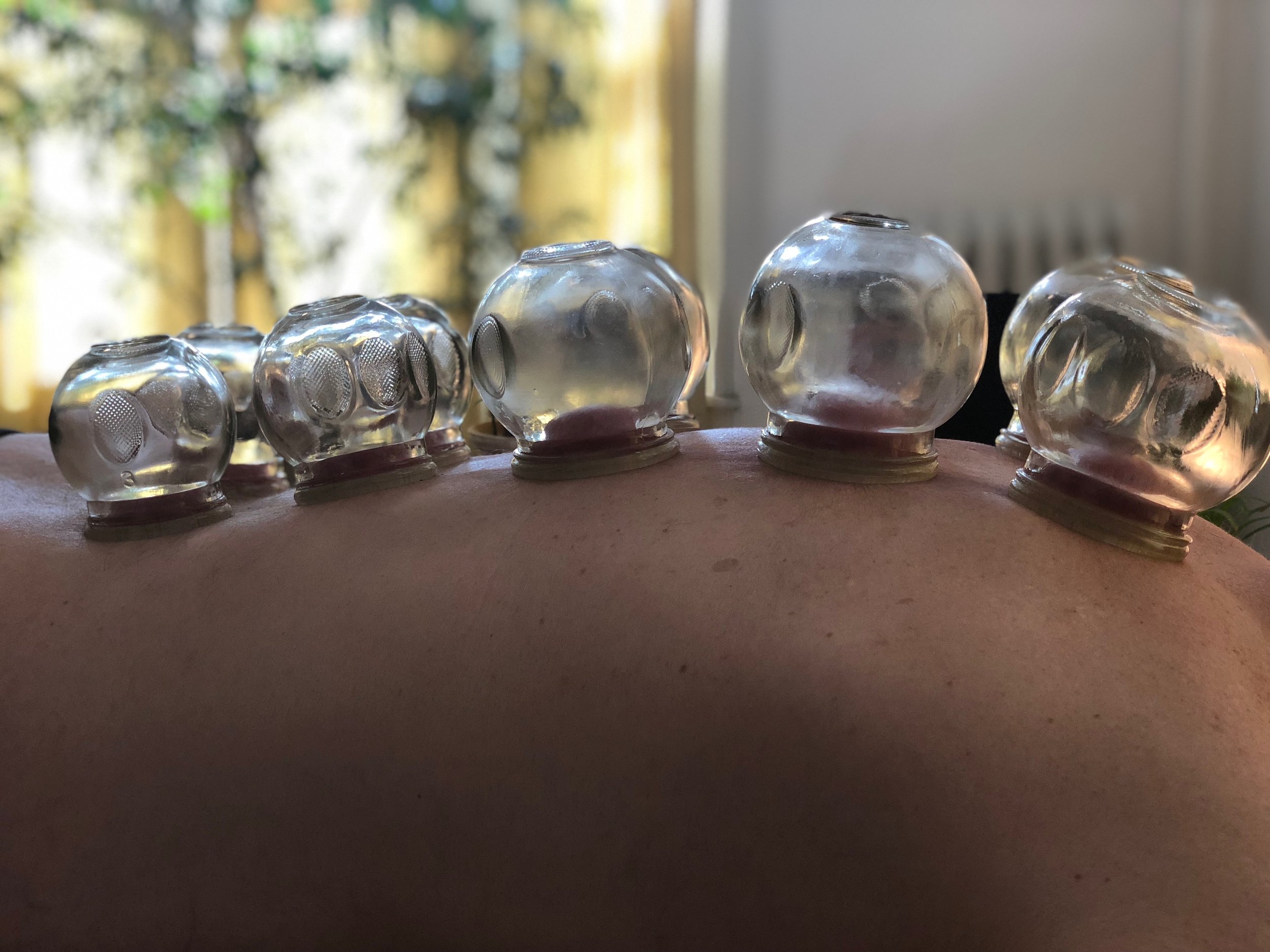 cupping image .jpeg