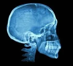 Brain Repair with NAC Supplement