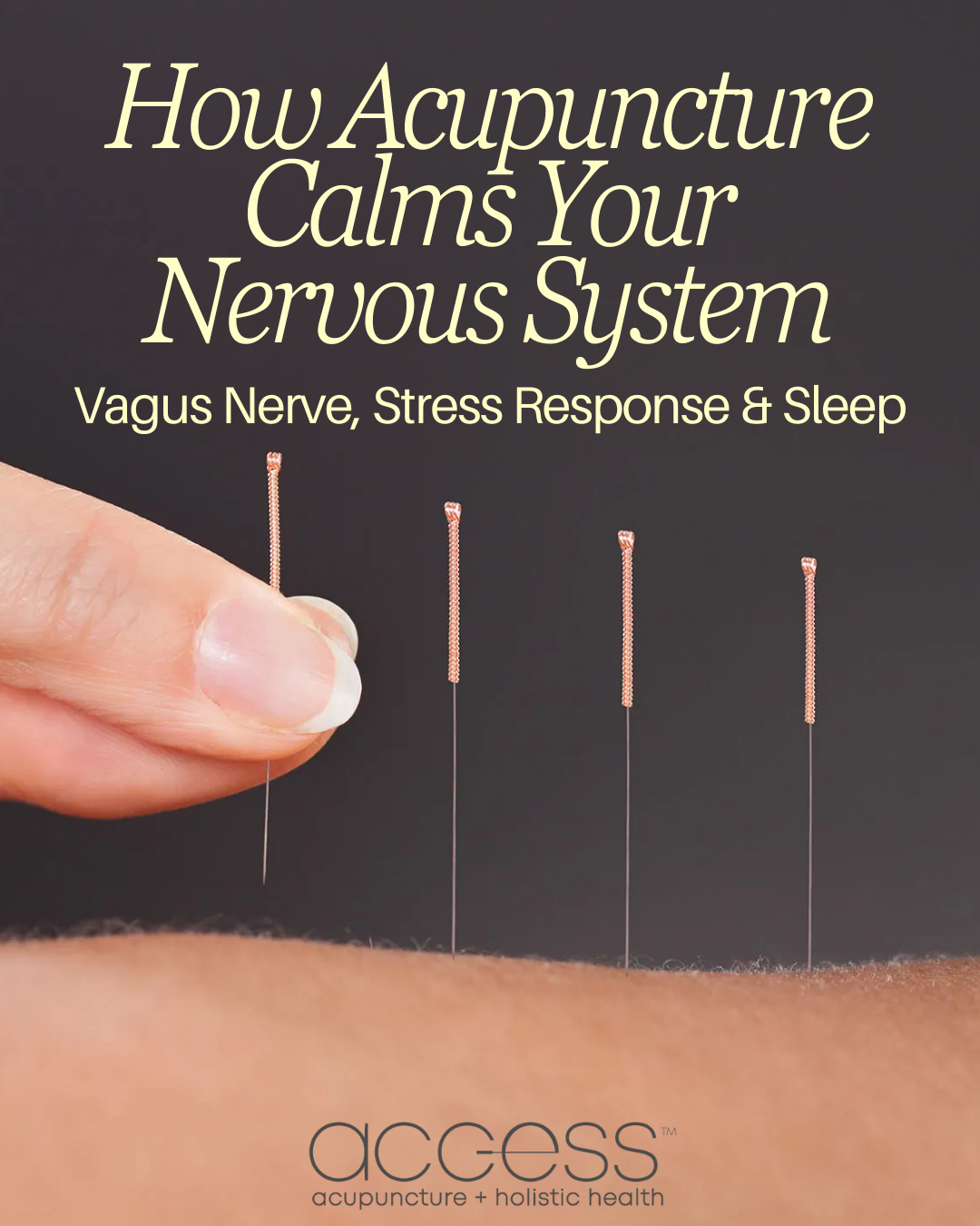 Acupuncture &amp; the Nervous System: How It Brings You Back Into Balance