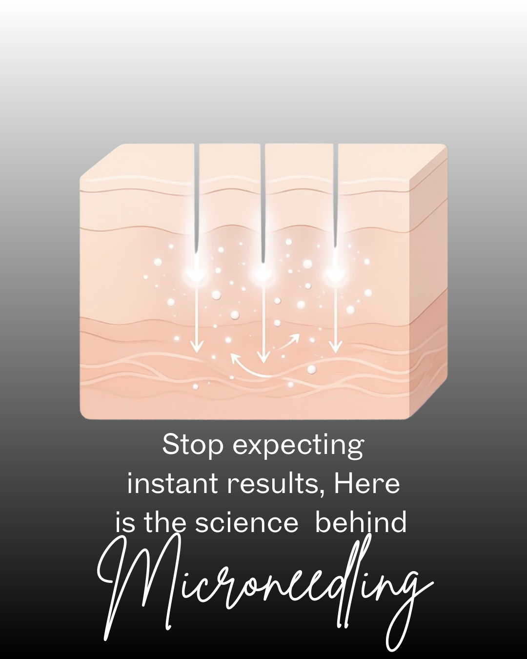 Stop expecting instant results from microneedling