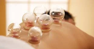 What happens when you combine acupuncture and cupping?