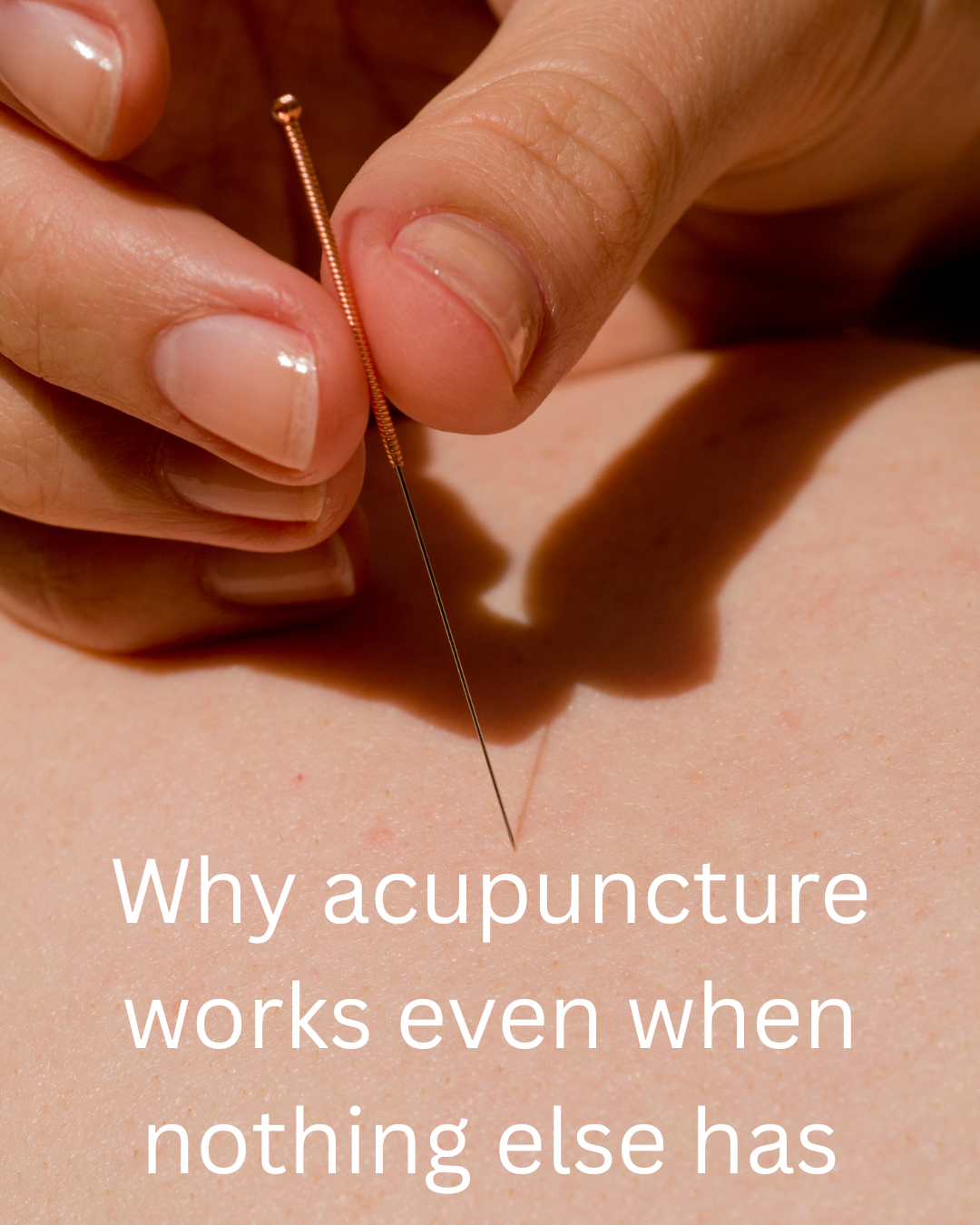 Why acupuncture works even when nothing else has