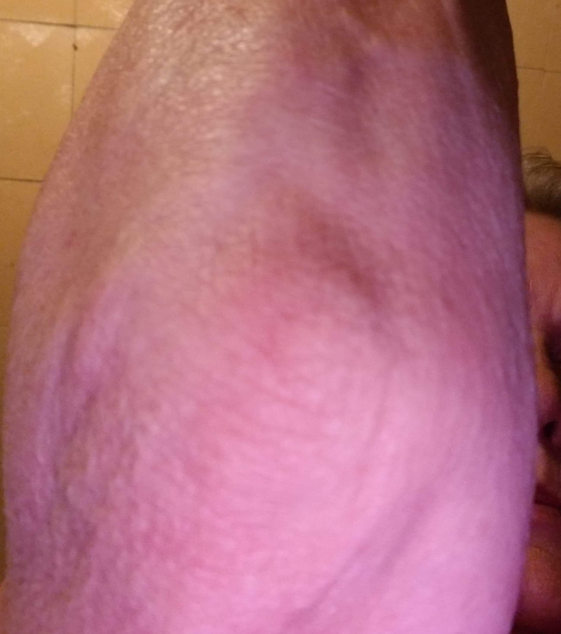 elbow help 3.jpeg