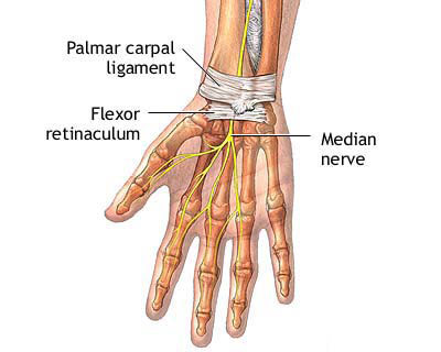 CTS_wrist.jpg