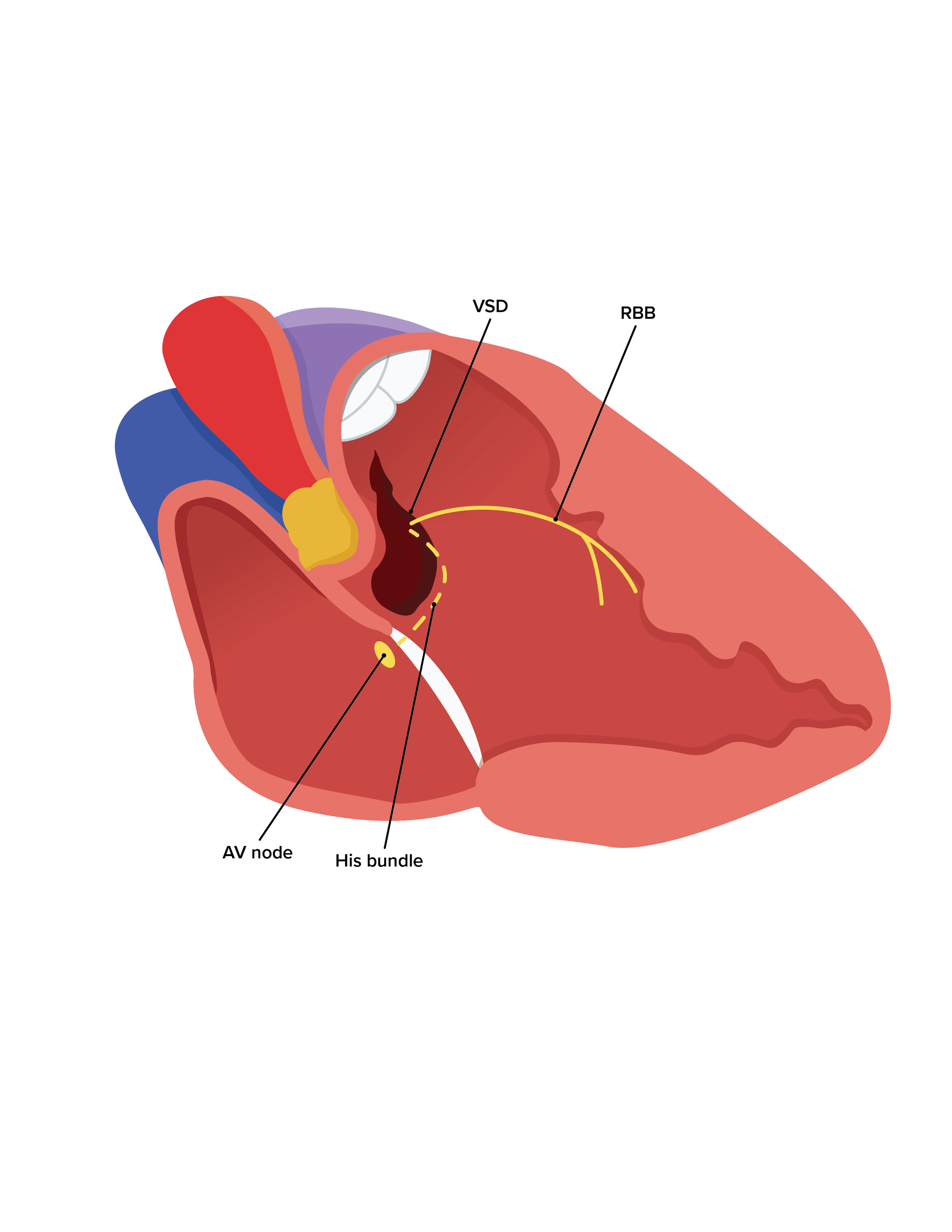VSD_CrossSection_02.png