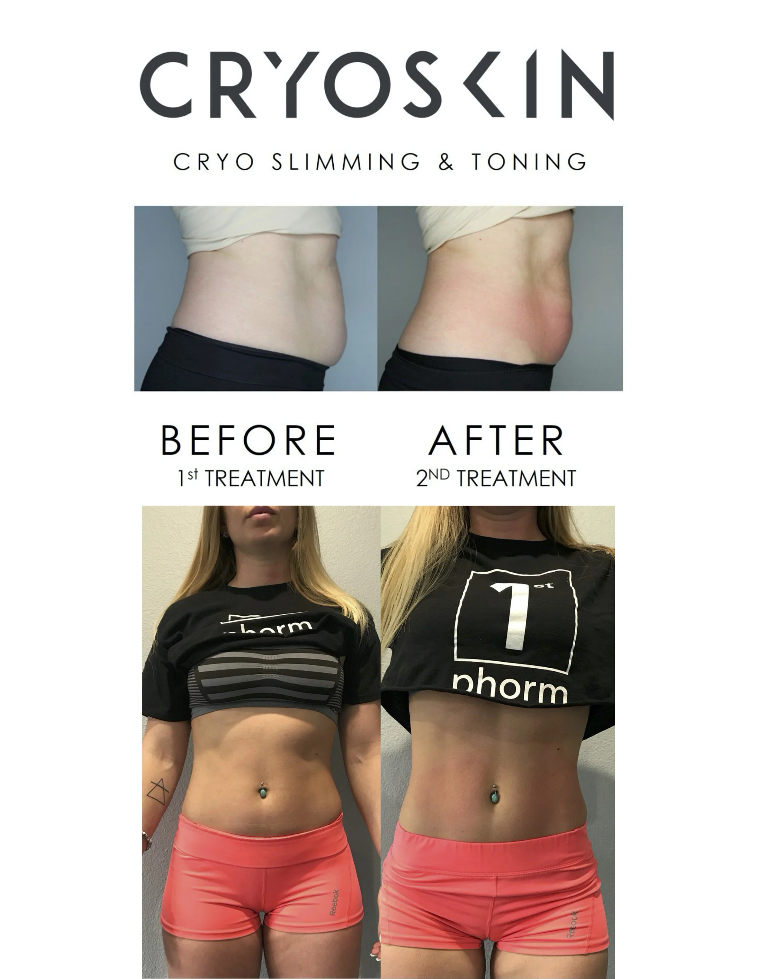 CryoSkin — True North Cryo