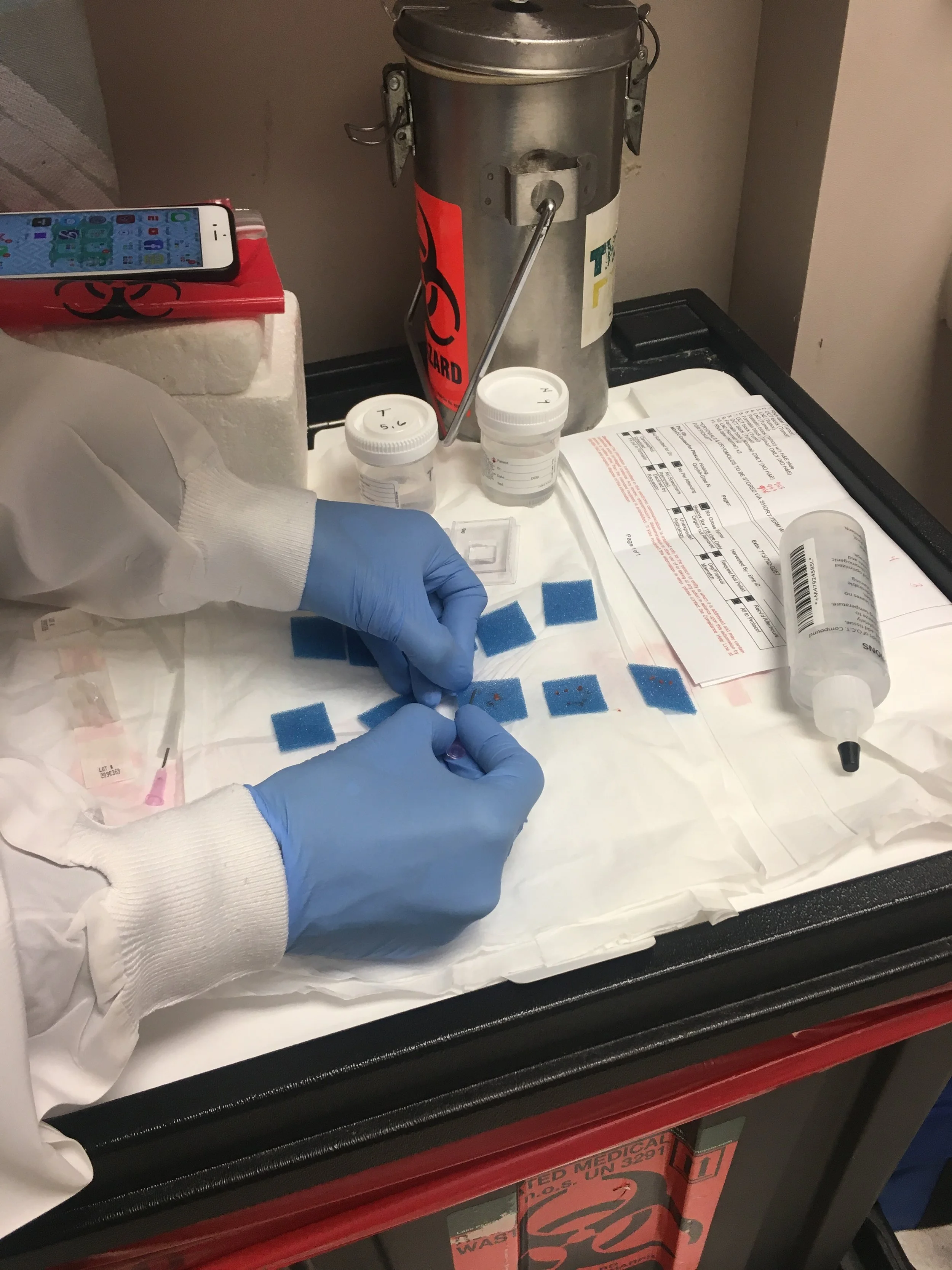 The Dirty Deets (Staging, Treatment, Side Effects)
