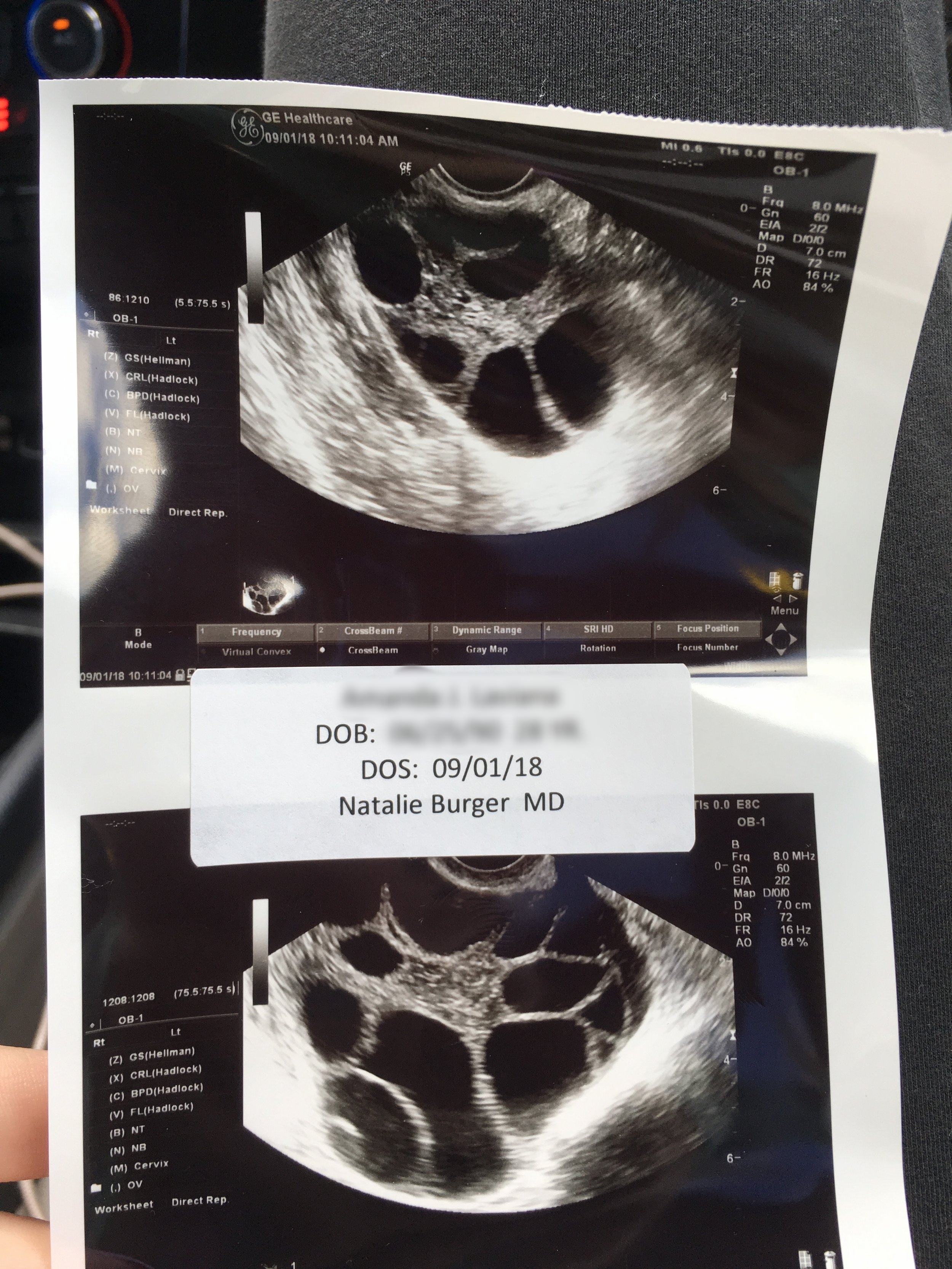 Fertility Preservation