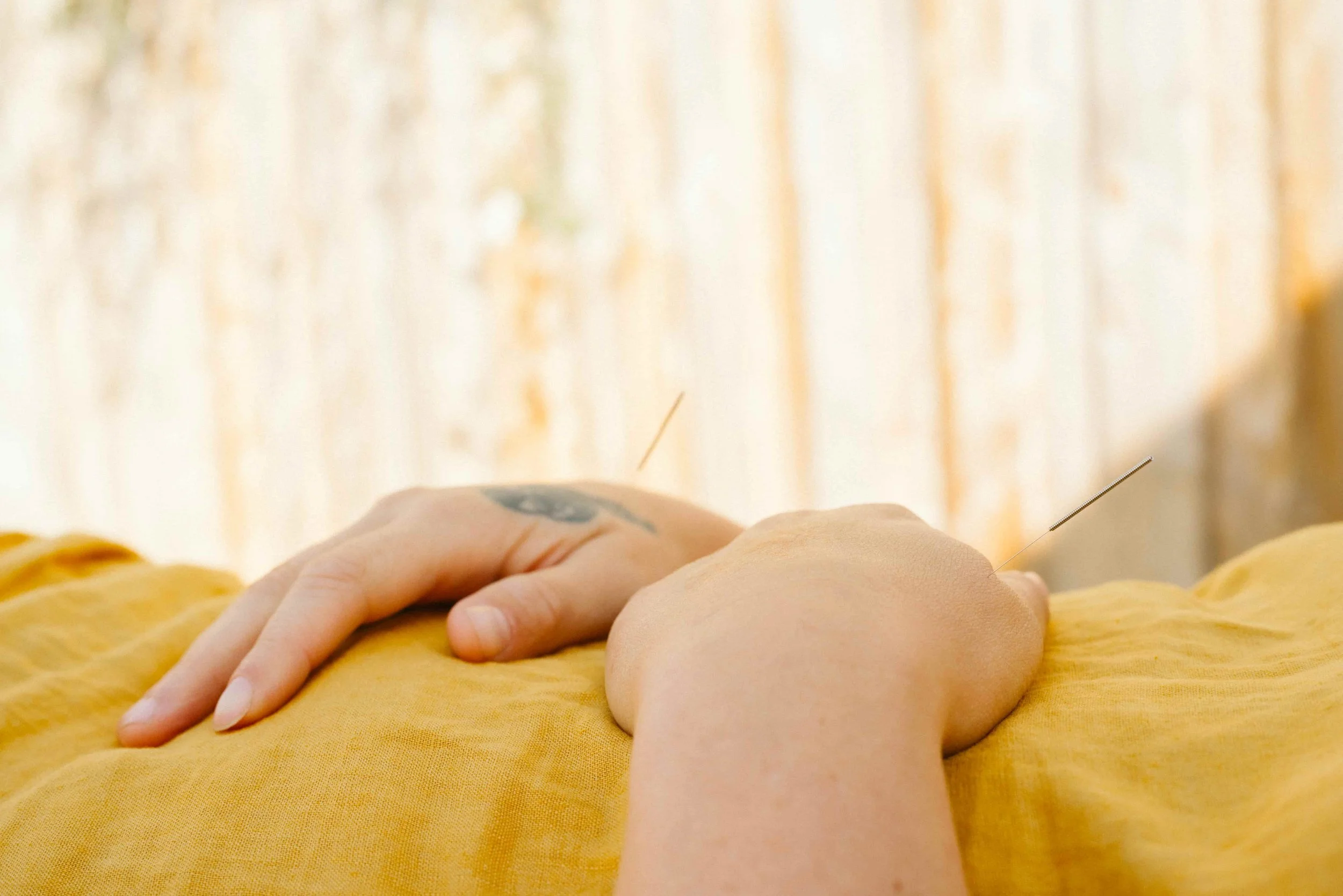 Close-up of a person lying down with acupuncture needles inserted into their body, on a yellow surface with a yellow cloth underneath.