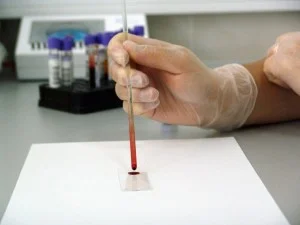 blood-lab-test.jpg