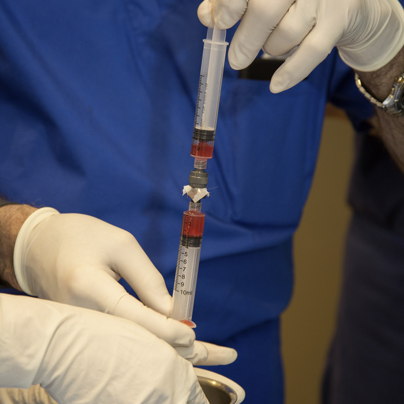 agefocus-stem-cell-harvesting-002.jpg