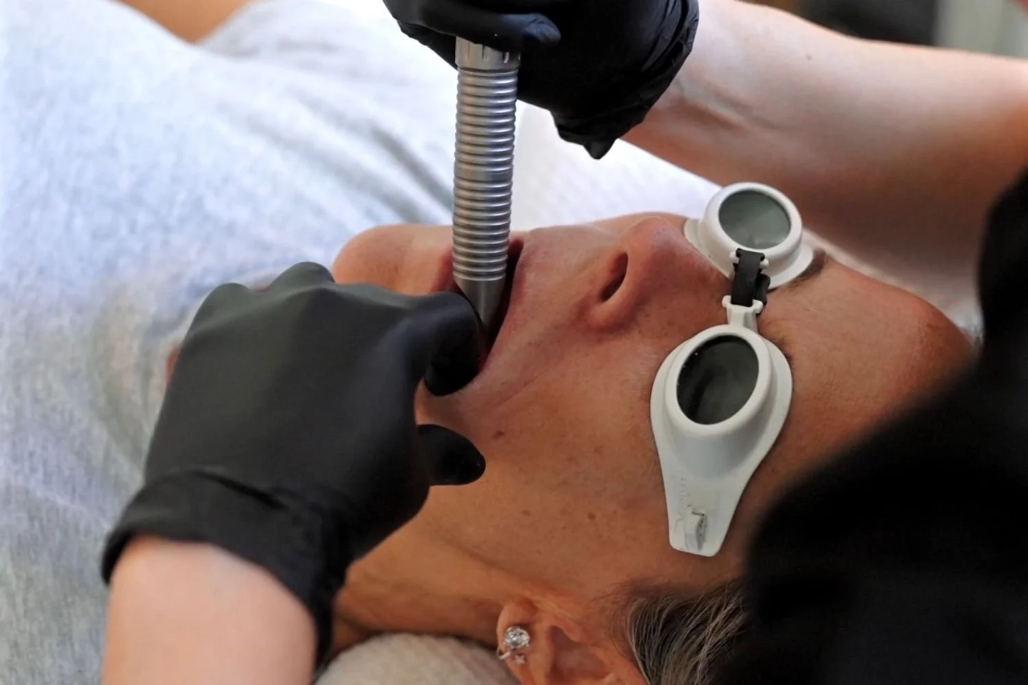 anso-med-spa-fotona-4d-lifting-intraoral-laser-nyc.jpg