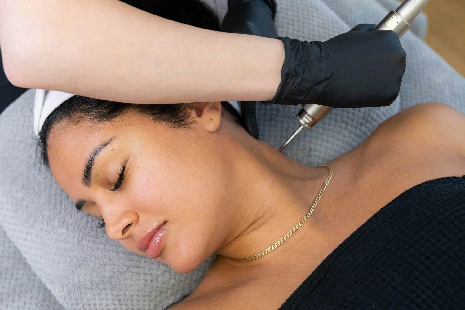 anso-med-spa-fotona-smooth-skin-tag-removal-laser-nyc.jpg