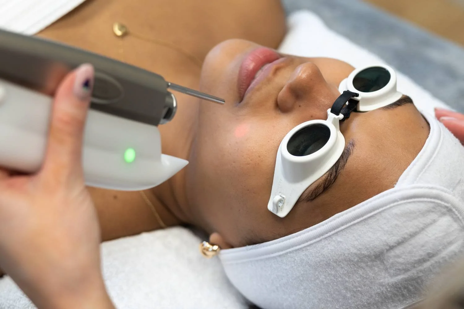 Fotona laser facial treatment at ANSO Med Spa Koreatown Midtown Manhattan NYC