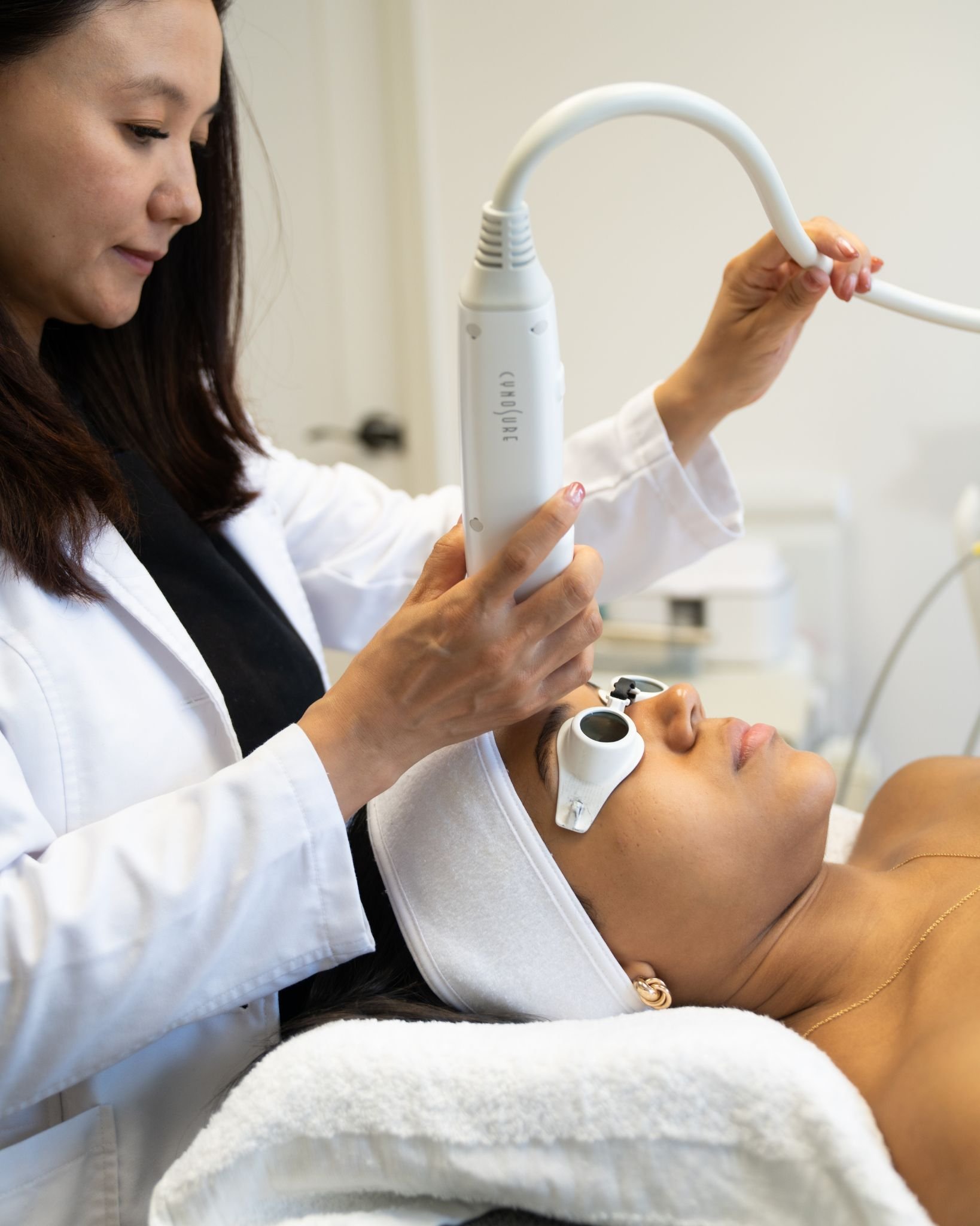 first time special potenza rf microneedling treatment