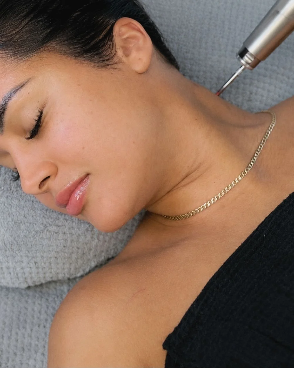 Piqo4 Laser Pigment at ANSO Med Spa NYC