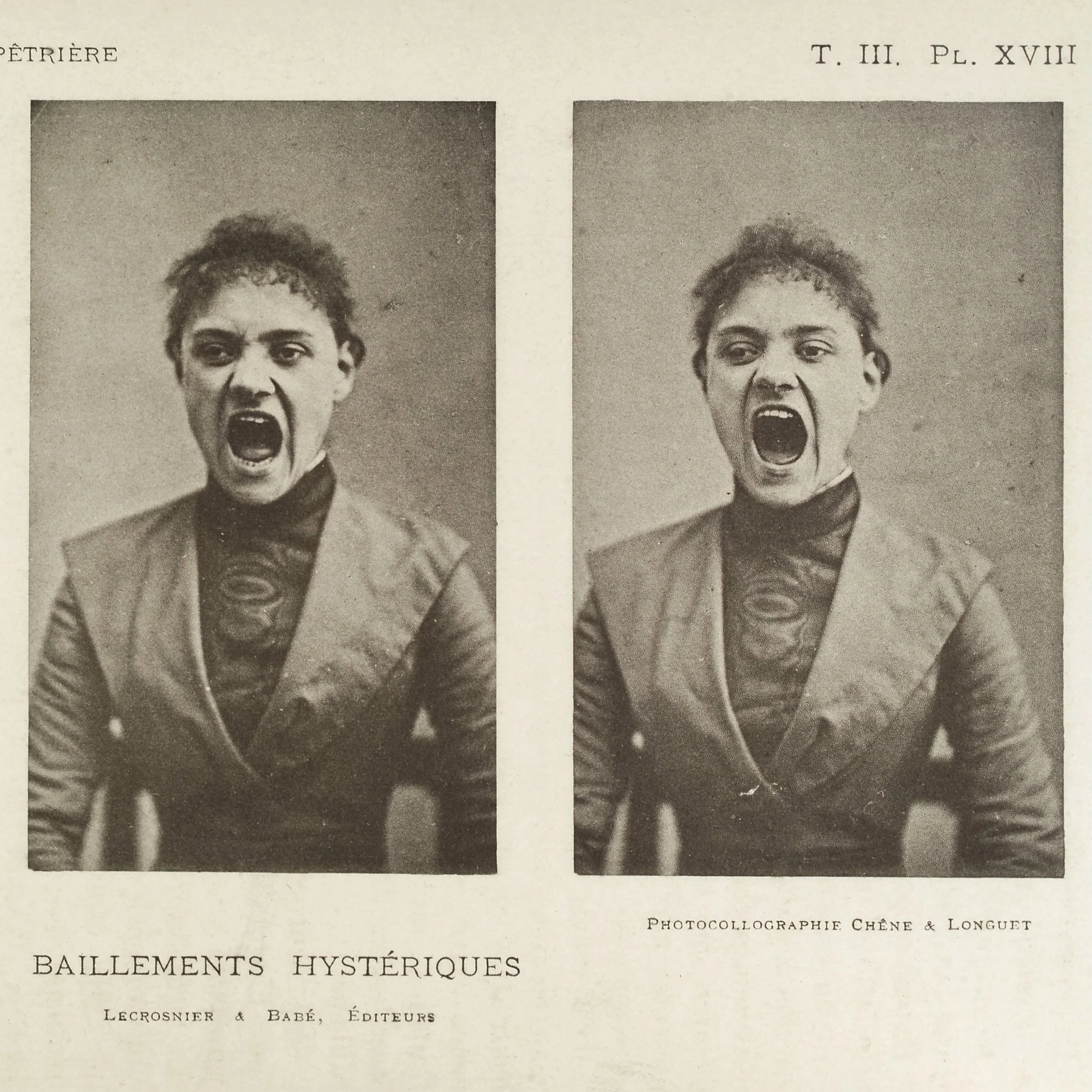 Online Talk · Performing Hysteria: Portraits of Hysteric Patients and Their Impact on Female Representation with Lucy Bink