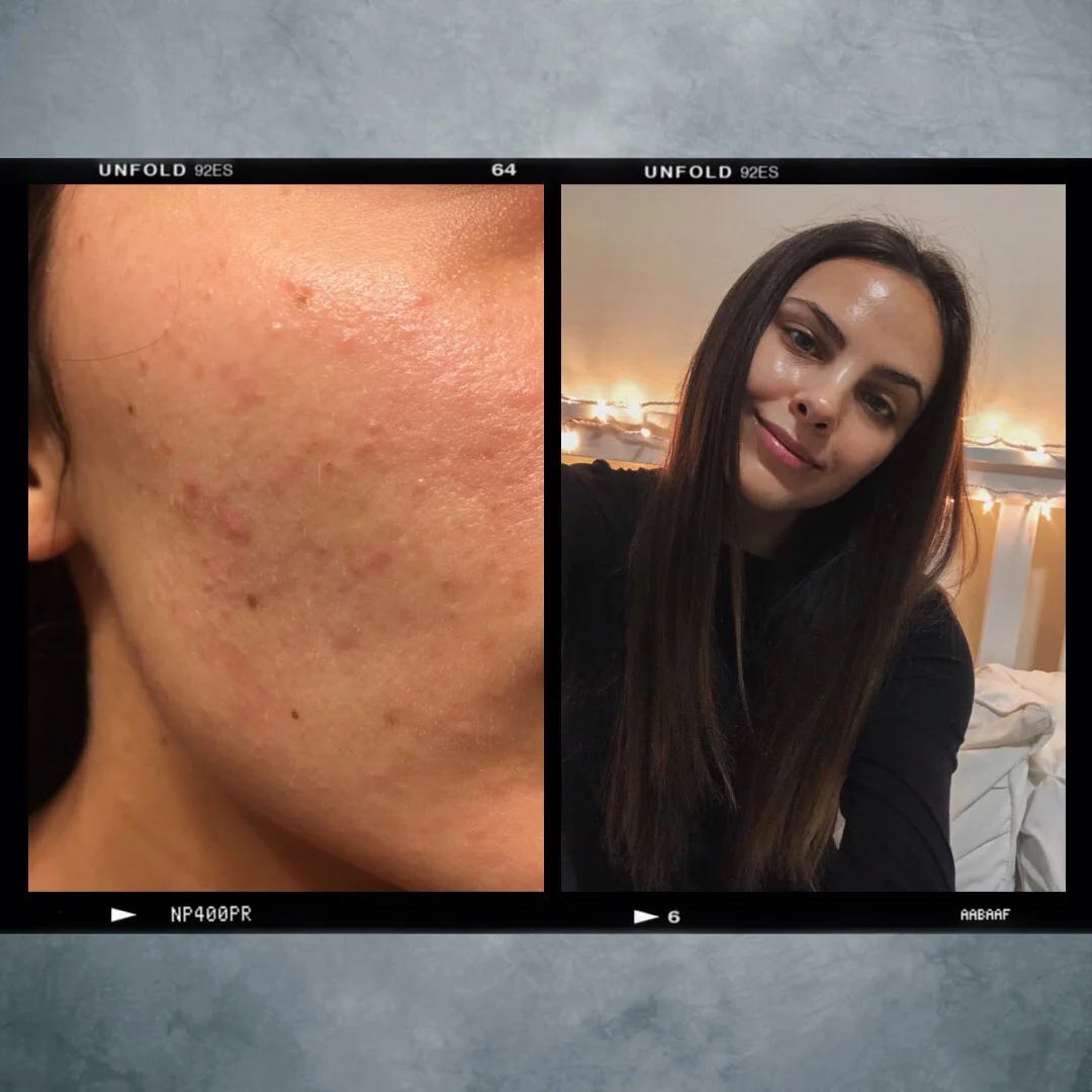 skin transformation.jpg