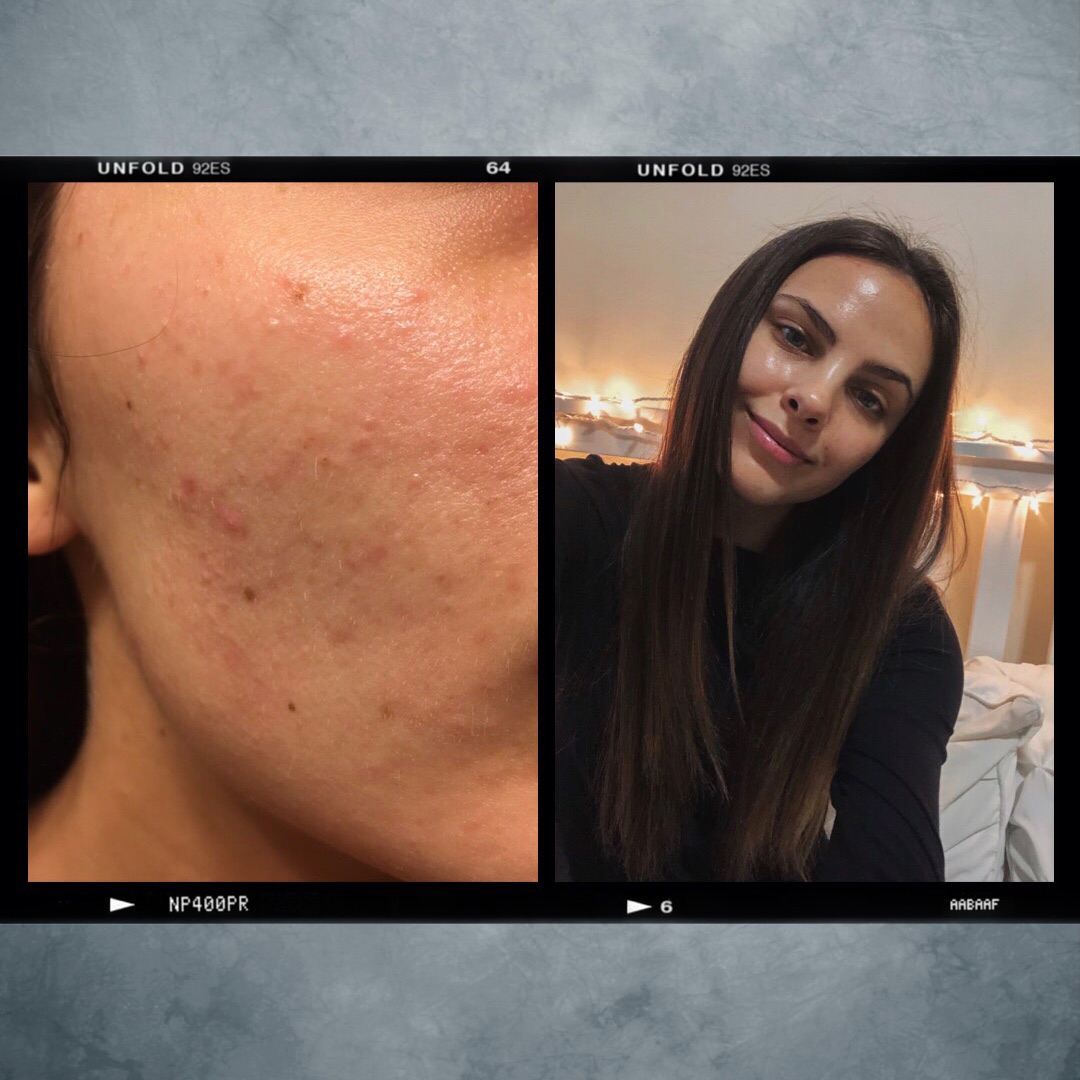 Shop My Exact Skincare Routine