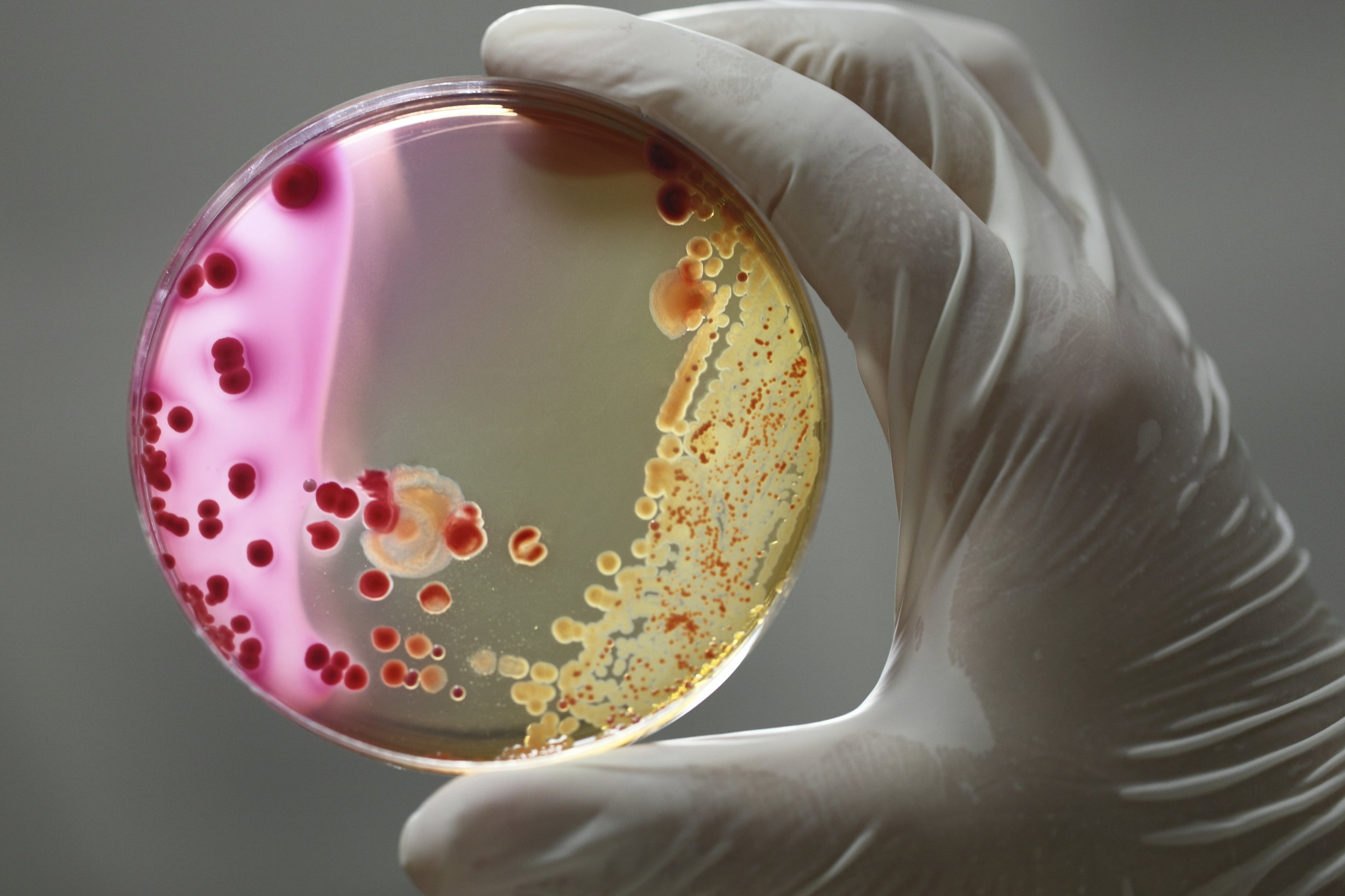 bacteria.jpeg