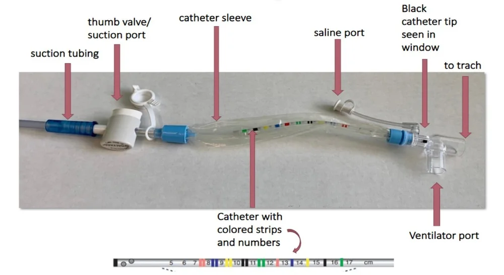 HINT How do I perform inline suctioning using a closed system